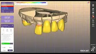 #inlab  #cerec  #millbox    #Exocad #Exoplan #Ceramill #Maestro3D #RealGuide #hyperdent  #3shape