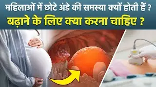 Small Egg Size Causes:अंडे अगर छोटे बनते है तो गर्भधारण कैसे करे, Egg Size & Quality For Pregnancy..