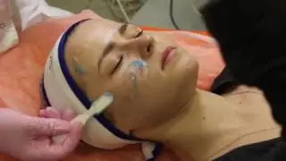 Пилинг Skin Tech easy droxy peel