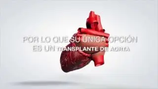 Transplante de aorta. Rumbo al centenario del Agente Aduanal