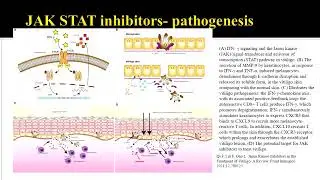 Immunosuppressive Therapy in Vitiligo : An Update