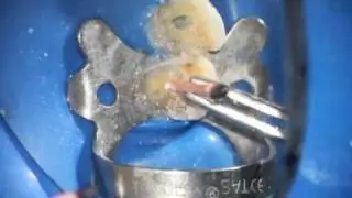 Nasseh Post Preparation Technique