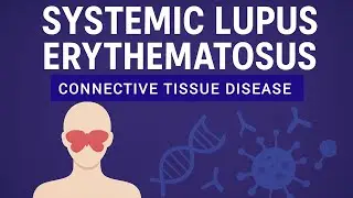 Systemic Lupus Erythematosus Explained | Symptoms, Diagnosis & Treatment | Medical Lecture