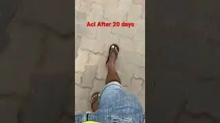 After 20days of acl surgery #ACL #aclsurgery