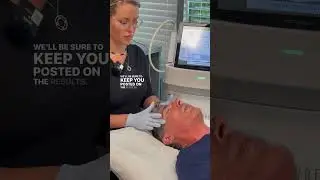Dr. Buonassisi's Potenza RF Microneedling