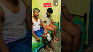 Tibia Fracture | Day-2 #bhuvikatv #physiotherapy #exercise #shortsfeed #shorts