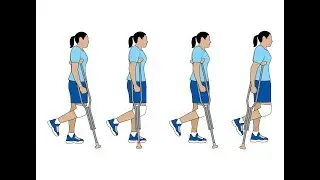 After ACL Surgery When Can I Walk? 10 Key Tips To Walking Normally Faster!