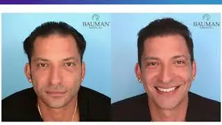 Panel of Discussion with Renowned Hair Loss Expert Dr. Alan Bauman