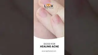 Look 18 AloeVera Face and Body Gel #AloeVeraGel #FaceAndBodyCare #SoothingTouch #SkinComfort