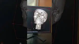 3d face ct kaise krte h #ct 3d face ki film kaise bnate h 