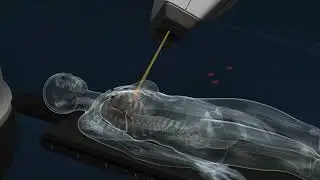 CyberKnife: Game Changer