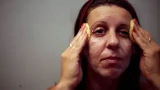 Treating Rosacea at home with IMAGE Skincare