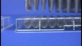 Magnetic Bead Extraction