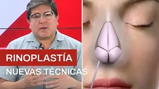 Nuevas T&eacute;cnicas en Rinoplast&iacute;a | Cl&iacute;nica Barrenechea