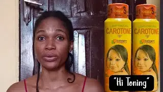 Best Brightening Lotion For Caramel Skin 