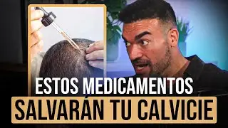Con estos 3 medicamentos puedes RECUPERAR tu pelo. ⁠Endocrino cuenta el por qu&eacute; de la calvicie