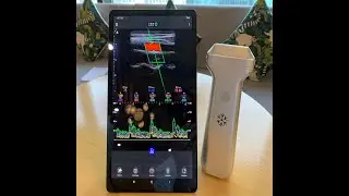 32-channel high-definition linear array ultrasound--new design
