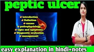 Peptic ulcer disease in Hindi |Types, causes, symptoms, and management of peptic ulcer