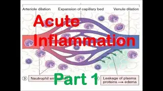 Acute Inflammation | Part 1 | e Pharma Classes | Free Pharma online lecture | Pharma lecture