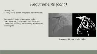 UR-49: Coronary Artery Segmentation Using Convolutional Neural Network