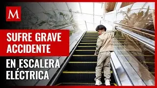 Niño en Perú pierde dedos del pie en escalera eléctrica