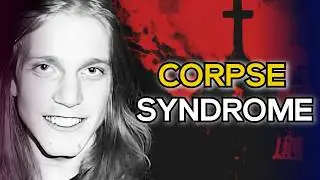 Jego najlepszy przyjaciel sprzedał fragmenty jego czaszki | Per Yngve Ohlin