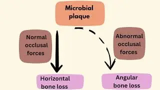 Periodontics- Glickman's concept/ Trauma from occlusion.#lecture #dental #traumafromocclusion