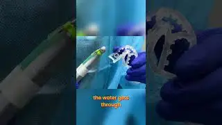 Open Surgical Guides: Keep Your Bone Cool During Dental Work #shorts