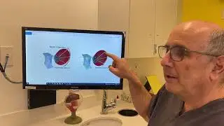 Hyperopic Defocus & Myopia Management with Dr. Moshe Mendelson | Silicon Valley Eye Physicians