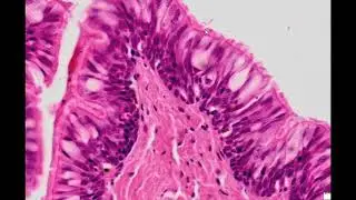 Pseudostratified ciliated epithelium (H&E staining) - PUMS Histology Slides Review Series