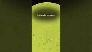 Entamoeba histolytica. // is a parasitic protozoan that causes amoebiasis.