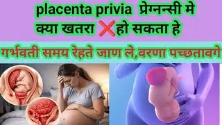 Placenta Previa During Pregnancy 😟 | Symptoms, Risks & Safe Delivery Explained #pregancy