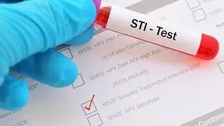 Lecture 94 # OB-GYN | Sexually transmitted Infections