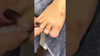 CRAZY Thick Cuticles Removal ep16 #amazing #cleaningenthusiast #nails #trending #viralvideo 