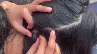 | @LaibaButt-b8t | Nits piking by Liana and little village girls |#haircareroutine |#headlice |