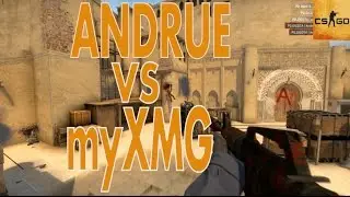 CS:GO - Andrue vs. myXMG