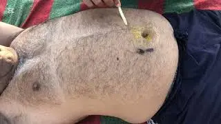 ULTIMATE RELAXATION ASMR CHEST,BACK AND HEAD MASSAGE | ON DEMAND BELLY BUTTON MASSAGE| RELAX OLD MAN