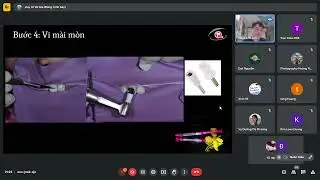 Điều Trị MIH Ở Nh&oacute;m Răng Ph&iacute;a Trước Bằng ICON DMG
