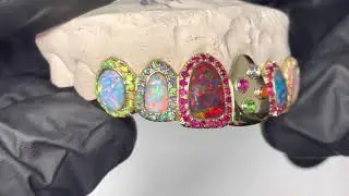 Top 6 Grillz w Multi-Colored Opal and Ruby Halos in Solid 18K Yellow Gold | Luxe Grillz