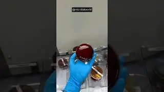 Different microorganisms grow on agar #love #foryou #shorts #youtubeshorts #trending #microbialworld