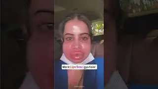 Urfi Javed&rsquo;s Face Shockingly Swollen &ndash; Fans Left Concerned 😢 #urfijaved #shortvideo #shorts