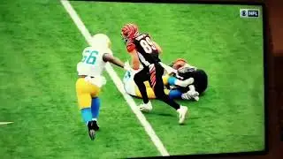 Drue Tranquil of the Los Angeles Chargers suffers a broken leg on a play.