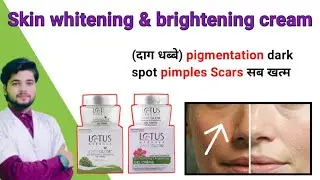 Lotus cream | lotus herbals whiteglow skin whitening and brightening gel cream | #ChemistwaladrX