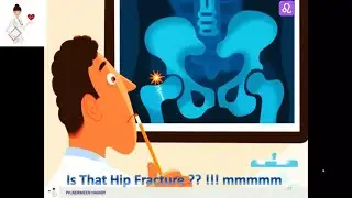 Board-Osteoporosis 6: Calcitonin-Salmon ( Miacalcic) & Raloxifene ( Evista )