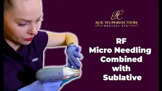 Try RF Microneedling + Sublative: You Won&rsquo;t Believe the Results!