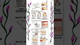 Neonatal resuscitation procedure 📝➡️✅#notes #pediatrics#shortvideo #education#bscnursing 👶🏻👶🏻