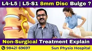 Non-Surgical Sciatica Treatment for L4-L5 & L5-S1 8mm Disc Bulge | Sun Physio