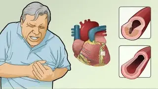 Natural Home Remedies for Heart Pain | Chest Pain | How to get rid of heart pain naturally@