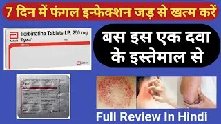 Tyza 250 mg Tablet | 7 दिन में फंगल इन्फेक्शन जड़ से खत्म करें | Terbinafine Tablet Uses In Hindi