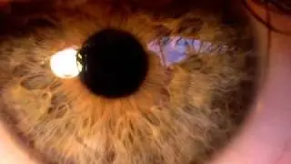 Pupil Dilation